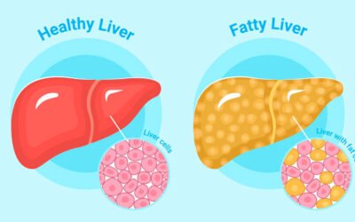 FATTY LIVER DISEASE